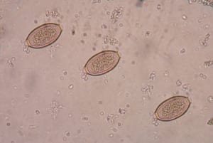 Microscope pictures of whipworms.