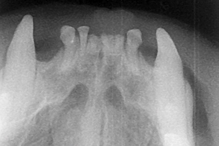 Making the Case for Dental Radiographs