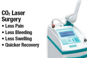 co2_laser_surgery